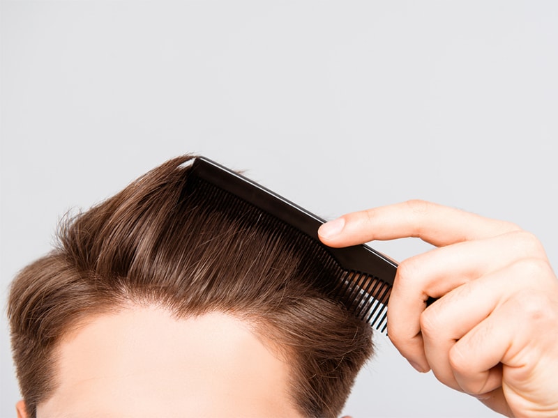 hair loss glower hair care barbers