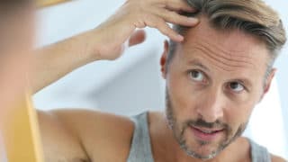 men hair loss treatments