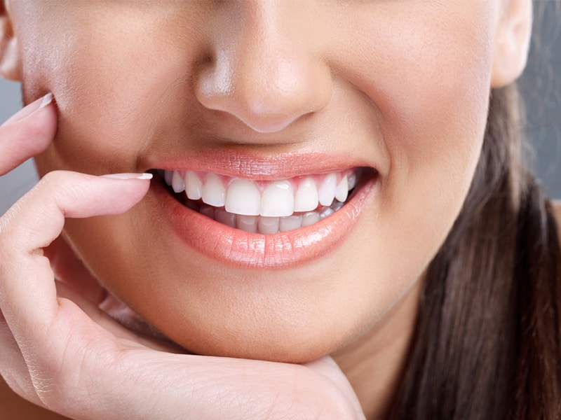 in-office teeth whitening singapore best dentist smilefocus teeth whitening kit whitening teeth kit 