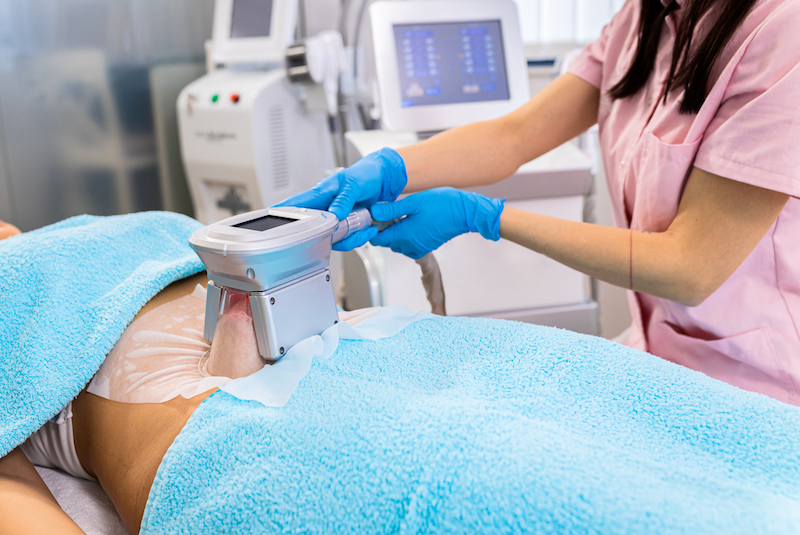 Tone up with Cryo-Sculpting Fat Removal