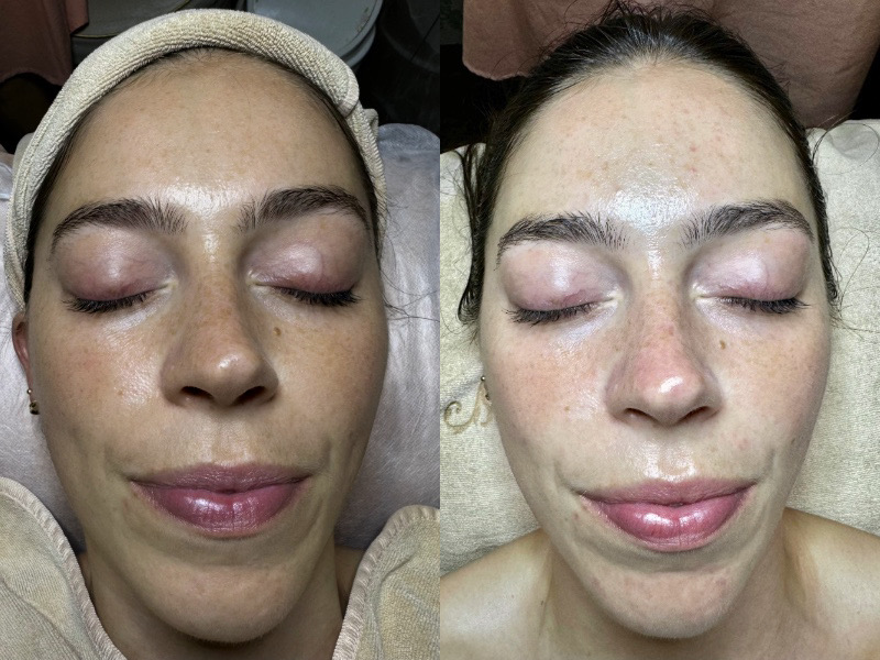 Best facials in Singapore - facial treatment and beauty salon reviews and face spas Fenella My Cozy Room best facials in Singapore and face spas