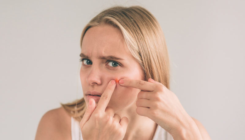 Woman pressing a pimple