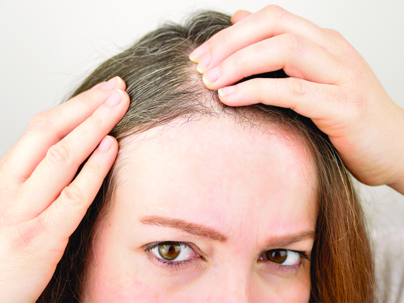 white hair treatment scalp ageing phs hairscience