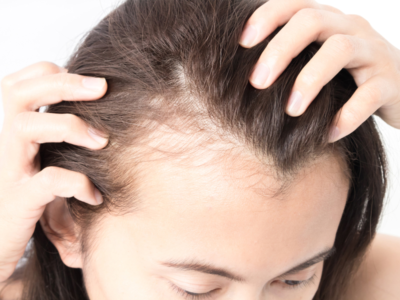 regenera activa singapore hair loss