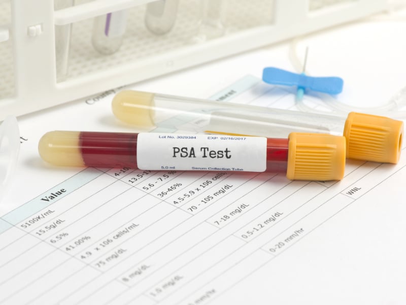 PSA test for prostate cancer screening 