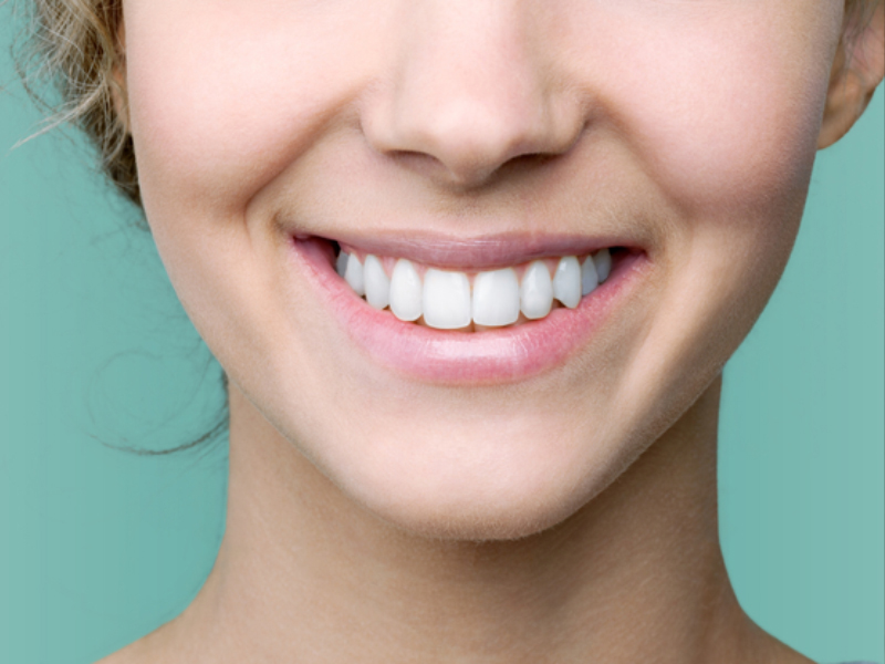 dental implants to fill gaps and Invisalign for straighter teeth 