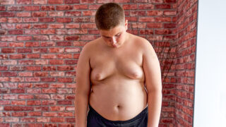 teenagers enlarged breasts teenagers swollen male nipple in puberty