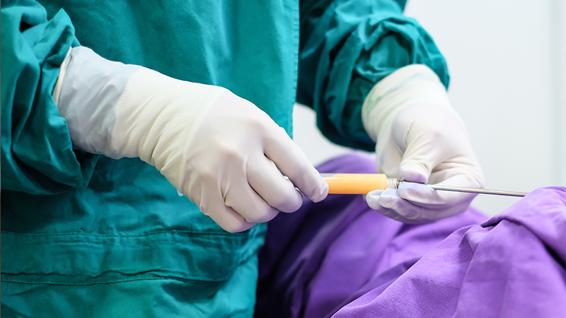 iposuction dr puah amarisb การปลูกถ่ายหรือปลูกถ่ายไขมันเพื่อเสริมหน้าอก