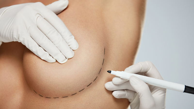 Change Breast Size with Breast Enlargement or Reduction Surgery