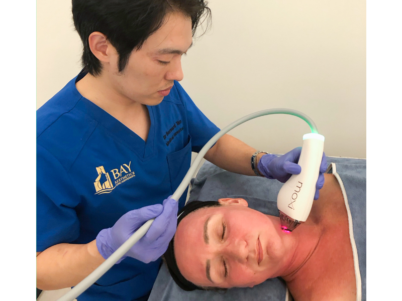 laser pigmentation treatment, Bay Aesthetics Clinic