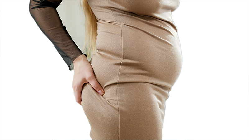 belly fat liposuction