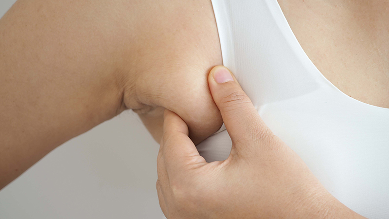 can woman have three breasts extra breast tissue under armpit removal