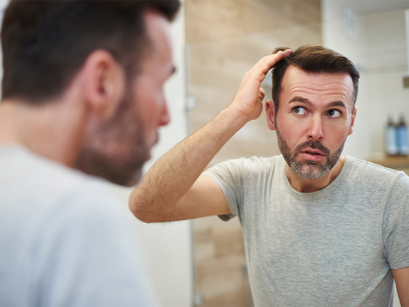 Stop losing hair; Bay Aesthetics Clinic treats telogen effluvium and various hair loss issues with hair transplants and hair serums