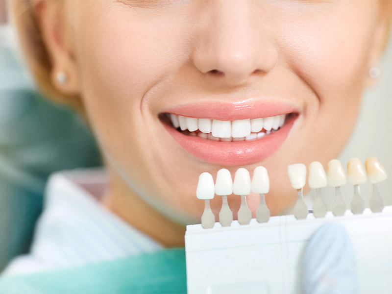 dental clinics teeth whitening kit whitening treatment 