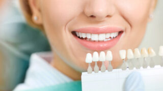 dental clinics teeth whitening kit whitening treatment