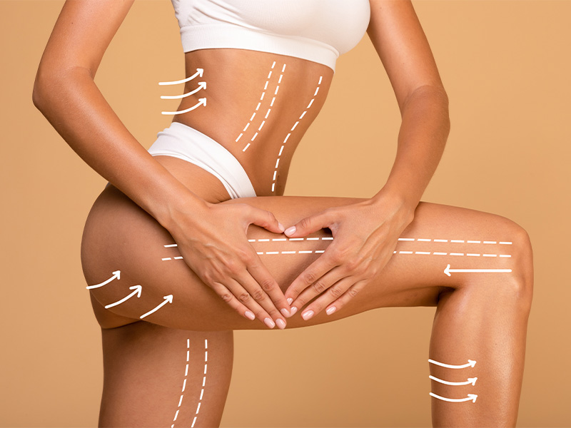 Liposuction in Singapore 101: What, Why, Where and How Much?