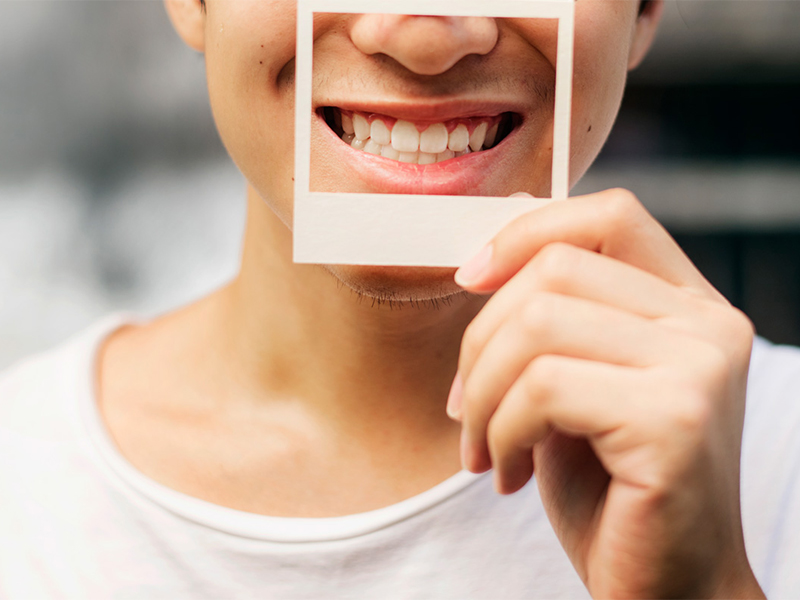 Dental clinics and Singapore dentists offering advanced treatments for teeth filling, teeth scaling, dental x-rays and more. 