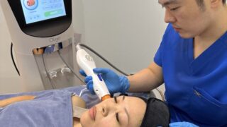 Radiofrequency treatment Oligio RF for eye bags, skin tightening and boosting collagen in the skin at Bay Aesthetics Clinic