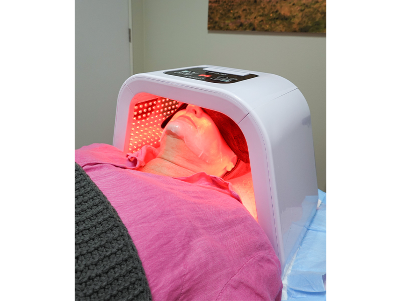 Pico laser for fading age spots, tattoos and melasma at La Clinic in Singapore