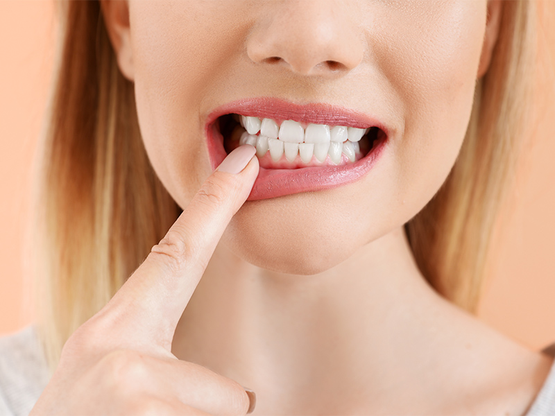 How to get beautiful teeth - SWT Straight White Teeth procedure at Smile Inc Dental Surgeons - without braces in Singapore