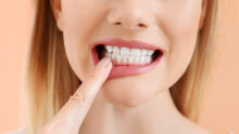How to get beautiful straight white teeth - SWT Straight White Teeth procedure at Smile Inc Dental Surgeons - without braces in Singapore