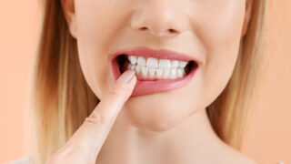 How to get beautiful straight white teeth - SWT Straight White Teeth procedure at Smile Inc Dental Surgeons - without braces in Singapore