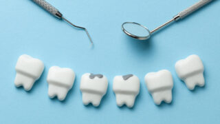 Dental clinics in Singapore and Singapore dentists offering teeth filling, smile makeover and other dental treatments