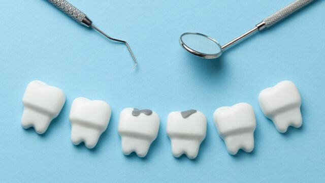 Dental clinics in Singapore and Singapore dentists offering teeth filling, smile makeover and other dental treatments