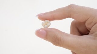 Dental crown in Singapore - what's dental crown - Dental Designs Clinic