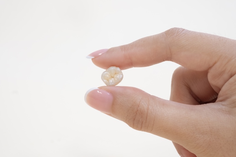 Dental crown in Singapore - what's dental crown - Dental Designs Clinic