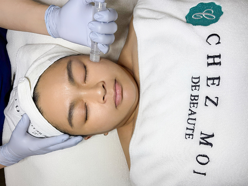 Chez Moi de Beauty Anti-ageing skin rejuvenation treatment in Singapore - skin tightening, ultherapy, facial for wrinkles and more