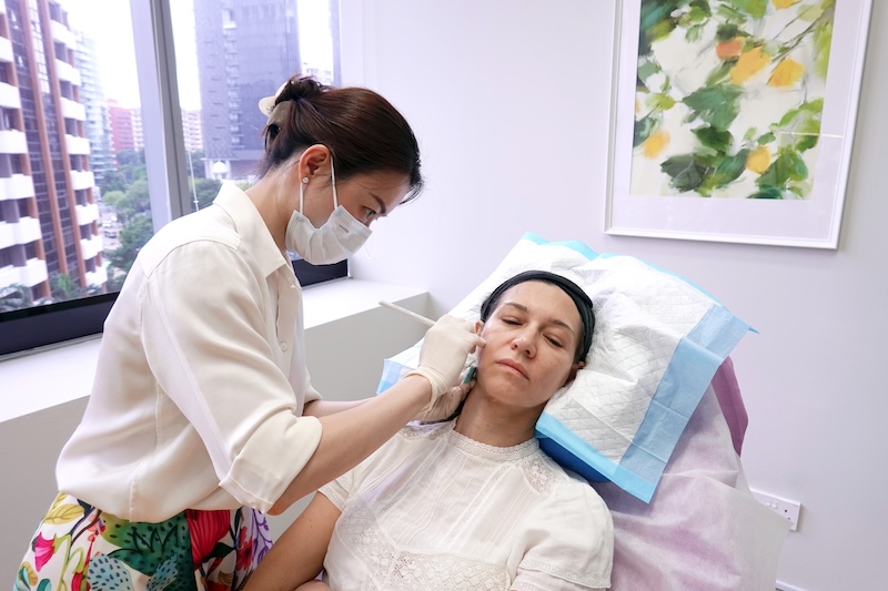 Benefits of hyaluronic acid injection for hollow cheeks