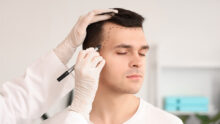 Hair loss treatment in Singapore - hair transplant, hair loss shampoo, hair growth lasers and more for thinning hair
