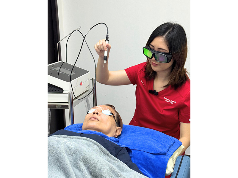 Laser treatments for the face, from fractional CO2 laser for pigmentation to laser for removing acne scars, melasma and more in Singapore. Laser treatments for the face, from fractional CO2 laser for pigmentation to laser for removing acne scars, melasma and more in Singapore.