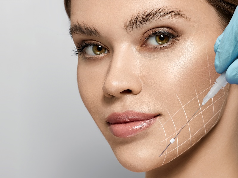 Fundamental Aesthetic Medical Clinic - non surgical face lift and PDO thread face lift - how do PDF threads work? 