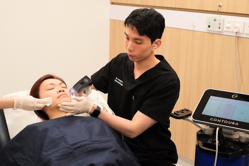 Radiofrequency microneedling