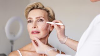Facelifts and neck lifts - what are deep plane facelifts - AZATACA Plastic Surgery in Singapore
