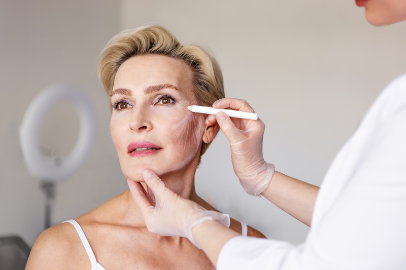 Facelifts and neck lifts - what are deep plane facelifts - AZATACA Plastic Surgery in Singapore