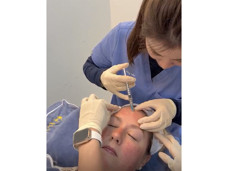 Skin boosters Singapore - human collagen ECM extracellular matrix skin boosters at Bay Aesthetics Clinic and Medispa