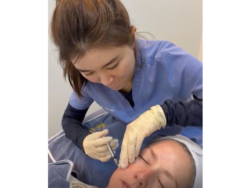 Skin boosters Singapore - human collagen ECM extracellular matrix skin boosters at Bay Aesthetics Clinic and Medispa